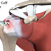 Rotator Cuff Tears