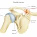 Clavicle Fracture (Broken Collarbone)