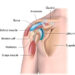 Dislocated Shoulder